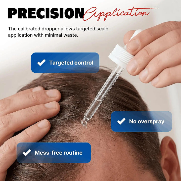 Kirkland Signature Minoxidil 5% Topical Solution for Men (Caja 6 unidades) Magic Mechas